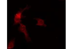 OR6C68 antibody  (C-Term)