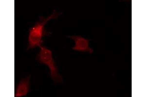 OR6C68 antibody  (C-Term)