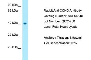 Western Blotting (WB) image for anti-Cyclin O (CCNO) (N-Term) antibody (ABIN2789909) (Cyclin O antibody  (N-Term))