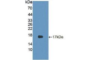 Figure. (CDKN2B antibody  (AA 1-130))