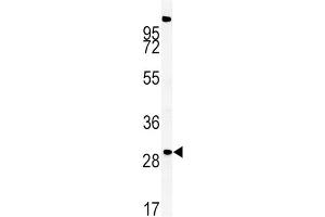 Western blot analysis of ZDHHC21 Antibody (N-term) in mouse liver tissue lysates (35ug/lane). (ZDHHC21 antibody  (AA 59-87))