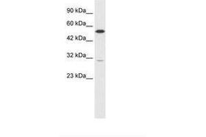 Image no. 1 for anti-Hepatocyte Nuclear Factor 4 gamma (HNF4G) (C-Term) antibody (ABIN6735846) (HNF4 gamma antibody  (C-Term))