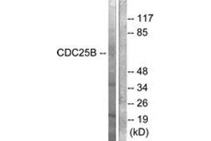 Western Blotting (WB) image for anti-Cell Division Cycle 25 Homolog B (S. Pombe) (CDC25B) (AA 289-338) antibody (ABIN2888593) (CDC25B antibody  (AA 289-338))