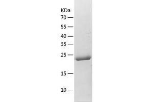 Western Blotting (WB) image for SWI/SNF Related, Matrix Associated, Actin Dependent Regulator of Chromatin, Subfamily B, Member 1 (SMARCB1) (AA 141-376) protein (His tag) (ABIN7287032) (SMARCB1 Protein (AA 141-376) (His tag))