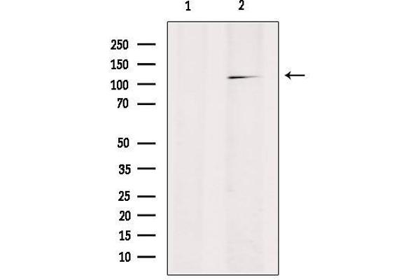 RANBP17 antibody  (N-Term)