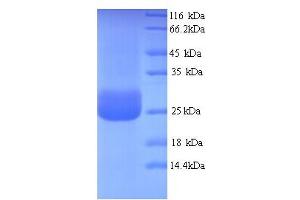SDS-PAGE (SDS) image for Immune Receptor Expressed On Myeloid Cells 1 (IREM1) (AA 20-156) protein (His tag) (ABIN5714420)