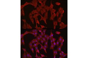 Immunofluorescence analysis of PC-12 cells using [KO Validated] Caspase-3 Rabbit pAb (ABIN6134639, ABIN6137978, ABIN6137979 and ABIN6215159) at dilution of 1:300 (40x lens). (Caspase 3 antibody  (AA 1-100))