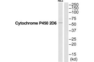 Western Blotting (WB) image for anti-Cytochrome P450, Family 2, Subfamily D, Polypeptide 6 (CYP2D6) (Internal Region) antibody (ABIN1852662) (CYP2D6 antibody  (Internal Region))
