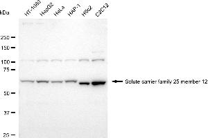 Western blotting analysis using solute carrier family 25 member 12 antibody (ABIN7800390).