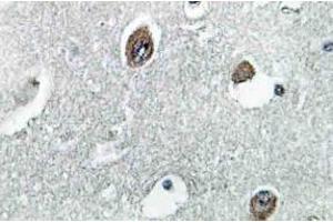Immunohistochemistry (IHC) analyzes of NDUFB10 antibody in paraffin-embedded human brain tissue. (NDUFB10 antibody)