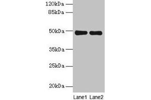 Western blot All lanes: MRPS5 antibody at 5 μg/mL Lane 1: Hela whole cell lysate Lane 2: Jurkat whole cell lysate Secondary Goat polyclonal to rabbit IgG at 1/10000 dilution Predicted band size: 49, 28 kDa Observed band size: 49 kDa (MRPS5 antibody  (AA 161-430))