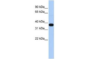 WB Suggested Anti-C1orf166 Antibody Titration:  0. (MUL1 antibody  (Middle Region))