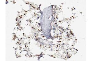 ABIN6266478 at 1/200 staining human Bone marrow tissue sections by IHC-P. (CEBPE antibody  (Internal Region))