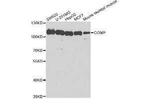 Western blot analysis of extracts of various cell lines, using COMP antibody. (COMP antibody  (AA 20-160))