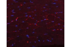 IF analysis of CAV3 using anti-CAV3 antibody (ABIN6719285). (Caveolin 3 antibody  (AA 1-55))