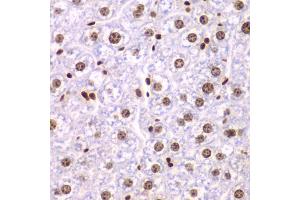 Immunohistochemistry of paraffin-embedded mouse liver using SSRP1 antibody (ABIN5973814) at dilution of 1/200 (40x lens). (SSRP1 antibody)