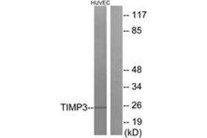 Western blot analysis of extracts from HuvEc cells, using TIMP3 Antibody. (TIMP3 antibody  (AA 91-140))