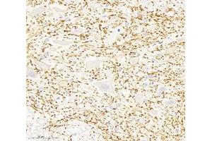 Immunohistochemistry analysis of paraffin-embedded rat spinal cord using,KCC2 (ABIN7075650) at dilution of 1: 1800