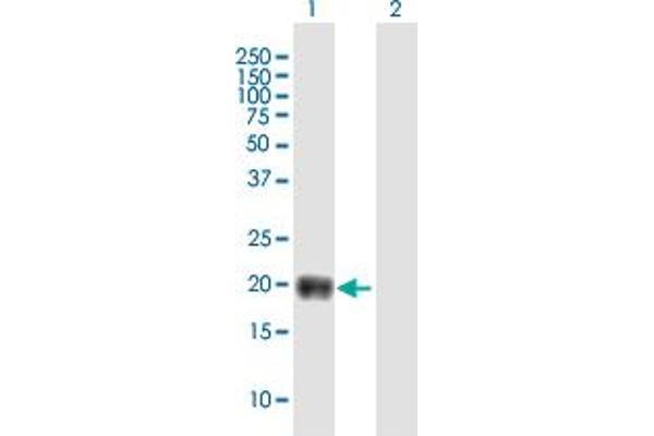 TMEM86B anticorps  (AA 1-226)