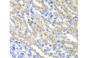 Immunohistochemistry of paraffin-embedded Rat kidney using SURF1 Polyclonal Antibody at dilution of 1:100 (40x lens). (SURF1 antibody)