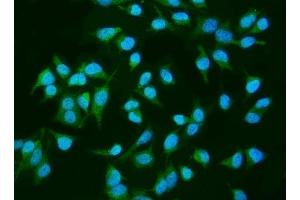 IF analysis of INPPL1 using anti-INPPL1 antibody (ABIN7599785).