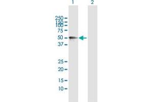 Western Blot analysis of MMP12 expression in transfected 293T cell line by MMP12 MaxPab polyclonal antibody. (MMP12 antibody  (AA 1-470))