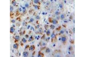 #VALUE! (Melatonin Receptor 1A antibody  (AA 300-353))