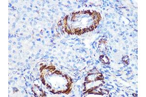 Immunohistochemistry of paraffin-embedded rat ovary using Caldesmon Rabbit mAb (ABIN7266024) at dilution of 1:100 (40x lens). (Caldesmon antibody)