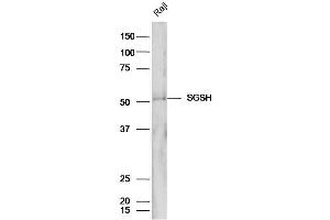 Raji cell lysates probed with Anti-SGSH/Sulphamidase Polyclonal Antibody, Unconjugated (ABIN1386573) at 1:300 in 4˚C. (SGSH antibody  (AA 301-388))