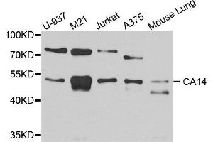 Western blot analysis of extracts of various cell lines, using CA14 antibody (ABIN5972614) at 1/1000 dilution. (CA14 antibody)