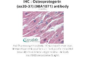 Image no. 2 for anti-Tumor Necrosis Factor Receptor Superfamily, Member 11b (TNFRSF11B) (AA 20-37) antibody (ABIN5693651) (Osteoprotegerin antibody  (AA 20-37))