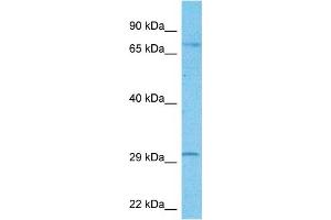 Host:  Rabbit  Target Name:  FOXR2  Sample Type:  U937 Whole Cell lysates  Antibody Dilution:  1. (FOXR2 antibody  (Middle Region))