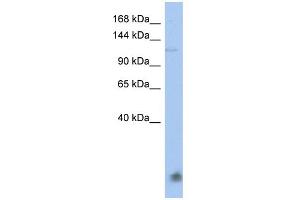 WB Suggested Anti-HERC5 Antibody Titration:  0. (HERC5 antibody  (N-Term))