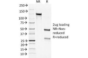 SDS-PAGE Analysis of Purified, BSA-Free Bcl2 Antibody cocktail (100/D5 + 124). (Bcl-2 antibody  (AA 41-54))