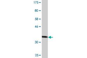 Western Blot detection against Immunogen (37. (DDB2 antibody  (AA 1-109))