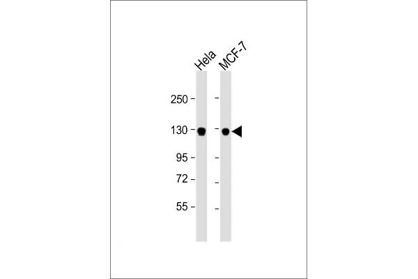 GTSE1 Antikörper  (C-Term)