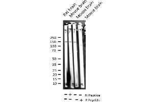 Western blot analysis of Phospho-ASK1 (Ser966) expression in various lysates (ASK1 antibody  (pSer966))