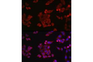 Immunofluorescence analysis of HeLa cells using Cyclin B1 Rabbit pAb (ABIN3022806, ABIN3022807, ABIN3022808 and ABIN6219237) at dilution of 1:150 (40x lens). (Cyclin B1 antibody  (C-Term))
