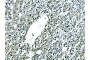 IHC analysis of CD101 using anti-CD101 antibody (ABIN7601981).
