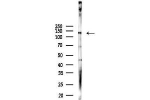 Western blot analysis of lysates from HUVEC cells(LPS 4h treatment), using PER2 Antibody at 1/1000 dilution.
