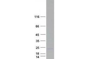Family with Sequence Similarity 72, Member D (FAM72D) protein (Myc-DYKDDDDK Tag)