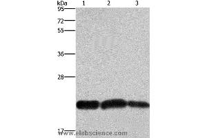 Western blot analysis of A375 and Raji cell, human fetal brain tissue, using CBX3 Polyclonal Antibody at dilution of 1:600 (CBX3 antibody)