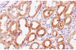 Immunohistochemistry of paraffin-embedded Human kidney using Pck1 Polyclonal Antibody at dilution of 1:100 (PCK1 antibody)