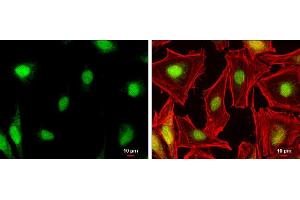 ICC/IF Image NR0B1 antibody detects NR0B1 protein at nucleus by immunofluorescent analysis.
