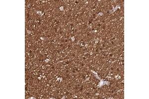 Immunohistochemical staining of human cerebral cortex with DEFB132 polyclonal antibody  shows strong cytoplasmic positivity in glial cells at 1:200-1:500 dilution. (DEFB132 antibody)