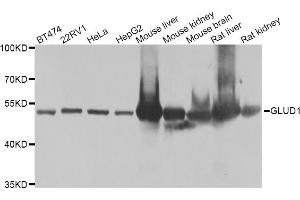 Western blot analysis of extracts of various cell lines, using GLUD1 antibody (ABIN5975614) at 1/1000 dilution. (GLUD1 antibody)