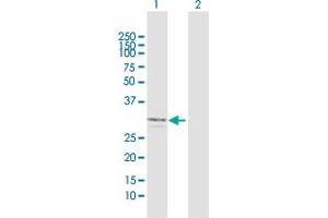 Western Blot analysis of FCN2 expression in transfected 293T cell line by FCN2 MaxPab polyclonal antibody. (Ficolin 2 antibody  (AA 1-313))