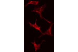 ABIN6274824 staining Hela cells by IF/ICC. (ADH7 antibody  (Internal Region))
