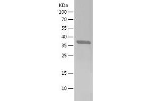 Western Blotting (WB) image for HBS1-Like (HBS1L) (AA 1-80) protein (His-IF2DI Tag) (ABIN7282413) (HBS1L Protein (AA 1-80) (His-IF2DI Tag))
