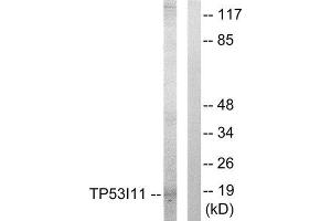 Western Blotting (WB) image for anti-Tumor Protein P53 Inducible Protein 11 (TP53I11) (Internal Region) antibody (ABIN1848934) (TP53I11 antibody  (Internal Region))
